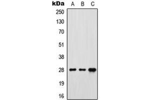 Western blot analysis of FR gamma expression in MCF7 (A), SP2/0 (B), rat brain (C) whole cell lysates. (FOLR3 antibody  (N-Term))