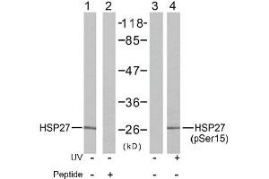 Image no. 2 for anti-Heat Shock 27kDa Protein 1 (HSPB1) (Ser15) antibody (ABIN197345) (HSP27 antibody  (Ser15))
