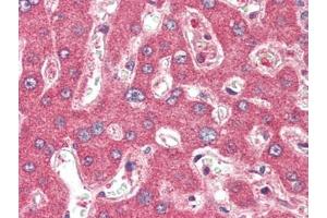 Human Liver (formalin-fixed, paraffin-embedded) stained with TSLPat 2. (Thymic Stromal Lymphopoietin antibody)