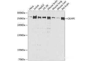 Western blot analysis of extracts of various cell lines using CKAP5 Polyclonal Antibody at dilution of 1:1000.