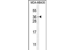 MYCT1 Antibody (C-term) (ABIN654473 and ABIN2844207) western blot analysis in MDA-M cell line lysates (35 μg/lane). (Myc Target 1 antibody  (C-Term))
