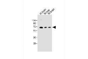 All lanes : Anti-GLS2 Antibody (C-term ) at 1:1000 dilution Lane 1: Human brain lysate Lane 2: Mouse liver lysate Lane 3: Mouse brain lysate Lysates/proteins at 20 μg per lane. (GLS2 antibody  (AA 498-524))