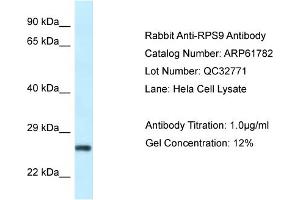 Western Blotting (WB) image for anti-Ribosomal Protein S9 (RPS9) (N-Term) antibody (ABIN2788902) (RPS9 antibody  (N-Term))