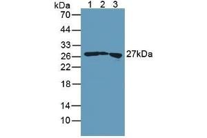 Figure. (Transgelin antibody  (AA 1-201))