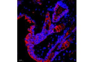 Immunofluorescence of paraffin embedded mouse skin using GDPD2 (ABIN7074098) at dilution of 1:650 (400x lens)