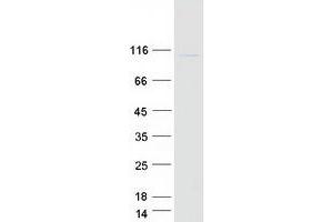 gamma 1 Adaptin Protein (Transcript Variant 1) (Myc-DYKDDDDK Tag)