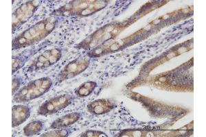 Immunostaining (ISt) image for anti-Translocase of Outer Mitochondrial Membrane 22 Homolog (TOMM22) (AA 1-142) antibody (ABIN566068)