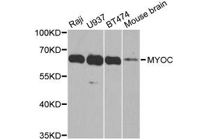 Western blot analysis of extracts of various cell lines, using MYOC antibody (ABIN5970768) at 1/1000 dilution. (MYOC antibody)