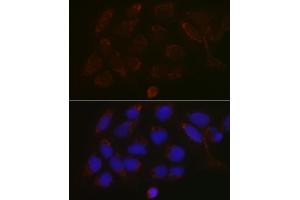Immunofluorescence analysis of U-2 OS cells using G Rabbit pAb (ABIN6131444, ABIN6140942, ABIN6140944 and ABIN6218180) at dilution of 1:100 (40x lens). (GALNT3 antibody  (AA 1-140))