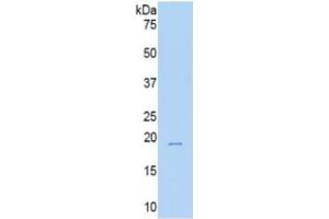 WB of Protein Standard: different control antibodies  against Highly purified E. (TNC ELISA Kit)