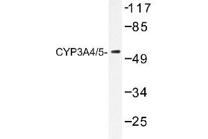 Image no. 1 for anti-Cytochrome P450, Family 3, Subfamily A, Polypeptide 4 (CYP3A4) antibody (ABIN272276)