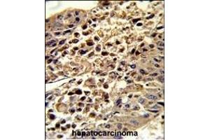 Immunohistochemistry (Paraffin-embedded Sections) (IHC (p)) image for anti-Voltage-Dependent Anion Channel 1 (VDAC1) (AA 95-124) antibody (ABIN390564)