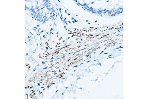 Immunohistochemistry (IHC) image for anti-Desmin (DES) (AA 121-470) antibody (ABIN3021115)