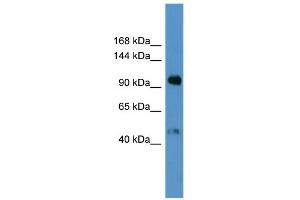 WB Suggested Anti-LPA Antibody Titration: 0. (LPA antibody  (N-Term))