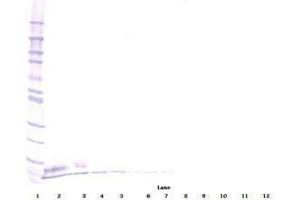 Image no. 2 for anti-Epidermal Growth Factor (EGF) antibody (ABIN465058) (EGF antibody)