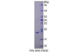 SDS-PAGE (SDS) image for Interleukin 12 Receptor, beta 2 (IL12RB2) (AA 559-647) protein (His tag) (ABIN1525467)
