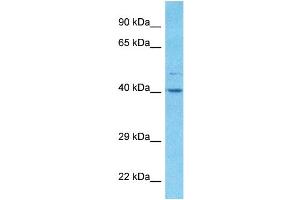 Host:  Rabbit  Target Name:  ALDOA  Sample Type:  RPMI-8226 Whole Cell lysates  Antibody Dilution:  1. (ALDOA antibody  (C-Term))
