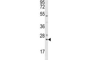 Western blot analysis of RAB7 antibody and K562 lysate. (RAB7A antibody  (AA 176-204))