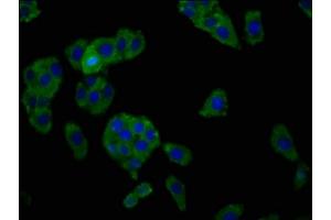 Immunofluorescence staining of HepG2 cells with ABIN7155172 at 1:166, counter-stained with DAPI. (SLC7A1 antibody  (AA 430-492))
