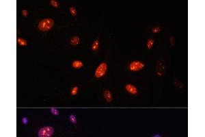 Immunofluorescence analysis of U-2 OS cells using ZNF177 Polyclonal Antibody at dilution of 1:100. (ZNF177 antibody)