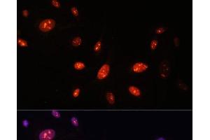 Immunofluorescence analysis of U-2 OS cells using ZNF177 Polyclonal Antibody at dilution of 1:100.