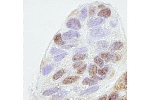 Immunohistochemistry (IHC) image for anti-Prohibitin 2 (PHB2) (AA 1-50) antibody (ABIN7448768) (Prohibitin 2 antibody  (AA 1-50))