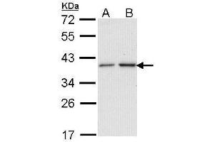 WB Image Sample (30 ug of whole cell lysate) A: A431 , B: H1299 12% SDS PAGE antibody diluted at 1:1000