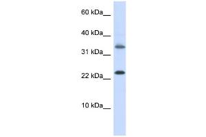 WB Suggested Anti-EMX1 Antibody Titration:  0. (EMX1 antibody  (Middle Region))