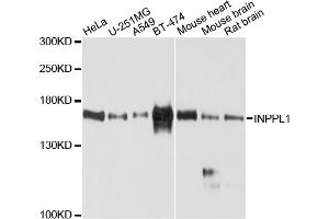 Western blot analysis of extracts of various cell lines, using INPPL1 antibody (ABIN4904065) at 1:1000 dilution.
