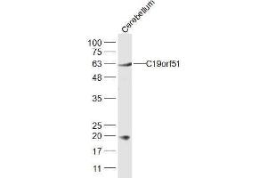 Mouse cerebellum lysates probed with C19orf51 Polyclonal Antibody, Unconjugated  at 1:300 dilution and 4˚C overnight incubation. (DNAAF3 antibody  (AA 151-250))