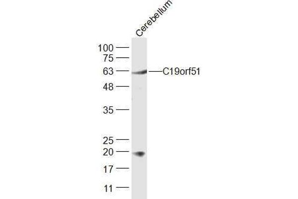 DNAAF3 antibody  (AA 151-250)