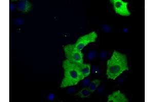 Image no. 7 for anti-Transforming, Acidic Coiled-Coil Containing Protein 3 (TACC3) antibody (ABIN1498099) (TACC3 antibody)