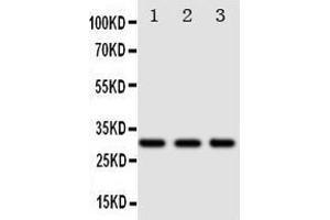 Anti-DR4 antibody, Western blotting Lane 1: SW620 Cell Lysate Lane 2: COLO320 Cell Lysate Lane 3:  Cell Lysate (TNFRSF10A antibody  (N-Term))