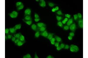 Immunofluorescence staining of Hela cells with ABIN7157277 at 1:100, counter-stained with DAPI. (KLHL2 antibody  (AA 1-200))