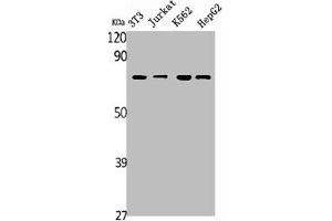 Western Blot analysis of NIH-3T3 Jurkat K562 HepG2 RAT-KIDNEY cells using SDHA Polyclonal Antibody (SDHA antibody  (C-Term))