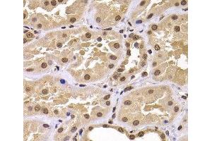 Immunohistochemistry of paraffin-embedded Human kidney using CSRP2BP Polyclonal Antibody at dilution of 1:100 (40x lens). (CSRP2BP antibody)