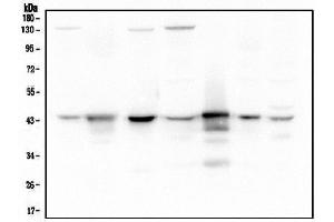 Western blot analysis of ADA using anti-ADA antibody (ABIN6719272).