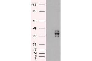 HEK293T cells were transfected with the pCMV6-ENTRY control (Left lane) or pCMV6-ENTRY OCT-4 (RC211998) (Right lane) cDNA for 48 hrs and lysed. (OCT4 antibody)
