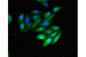 Immunofluorescent analysis of HepG2 cells using ABIN7147139 at dilution of 1:100 and Alexa Fluor 488-congugated AffiniPure Goat Anti-Rabbit IgG(H+L) (ITGB1 antibody  (AA 297-380))