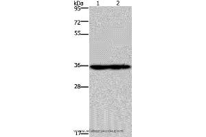 Western blot analysis of Mouse heart and kidney tissue, using NDUFA9 Polyclonal Antibody at dilution of 1:400
