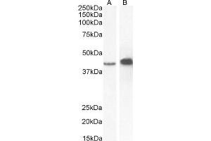 (ABIN2613379) (0. (AMACR antibody  (C-Term))