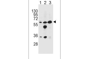 Western blot analysis in HL-60(lane 1),MDA-MB453(lane 2),K562(lane 3) cell line lysates (35ug/lane). (GATM antibody  (N-Term))