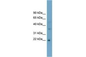 Image no. 1 for anti-Low Density Lipoprotein Receptor Class A Domain Containing 1 (LDLRAD1) (AA 107-156) antibody (ABIN6743318) (LDLRAD1 antibody  (AA 107-156))