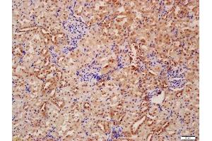 Formalin-fixed and paraffin embedded rat kidney labeled with Anti-Beclin 1/ATG6 Polyclonal Antibody, Unconjugated  at 1:200 followed by conjugation to the secondary antibody and DAB staining