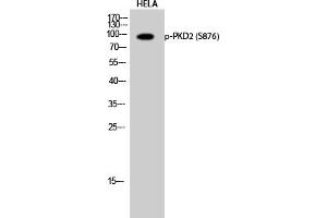Western Blotting (WB) image for anti-Polycystic Kidney Disease 2 (Autosomal Dominant) (PKD2) (pSer876) antibody (ABIN5962048) (PKD2 antibody  (pSer876))