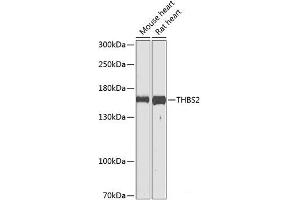 Western blot analysis of extracts of various cell lines using THBS2 Polyclonal Antibody at dilution of 1:1000. (Thrombospondin 2 antibody)