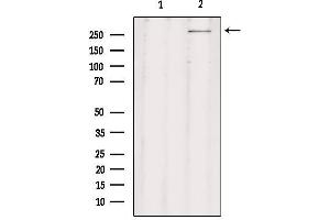 Western blot analysis of extracts from rat brain, using CHD8 Antibody. (CHD8 antibody  (C-Term))