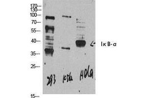 Western Blotting (WB) image for anti-Nuclear Factor of kappa Light Polypeptide Gene Enhancer in B-Cells Inhibitor, alpha (NFKBIA) (N-Term) antibody (ABIN3185247) (NFKBIA antibody  (N-Term))