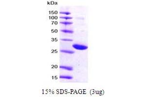 SDS-PAGE (SDS) image for 14-3-3 zeta (YWHAZ) (AA 1-245) protein (His tag) (ABIN667073)