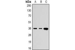 Western blot analysis of TBP expression in Hela (A), mouse brain (B), rat brain (C) whole cell lysates. (TBP antibody)